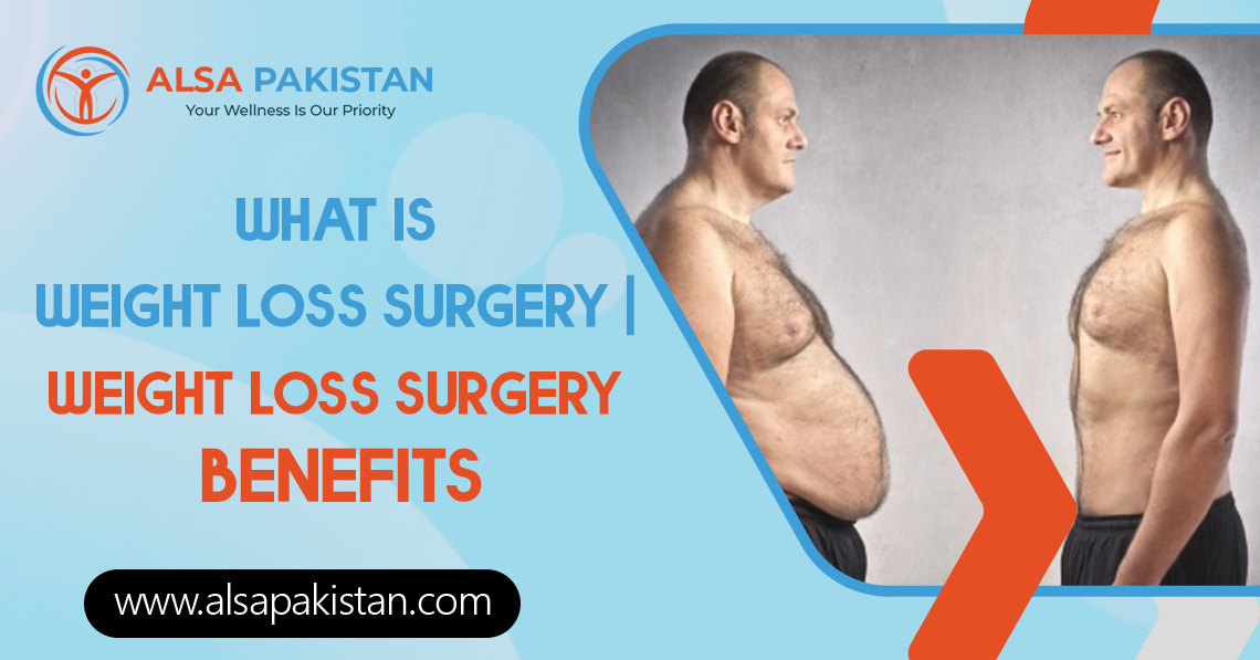 What is weight loss surgery Weight loss surgery benefits