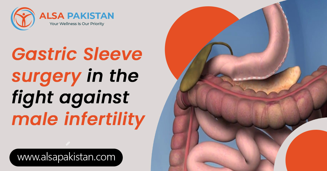 Gastric Sleeve surgery in the fight against male infertility