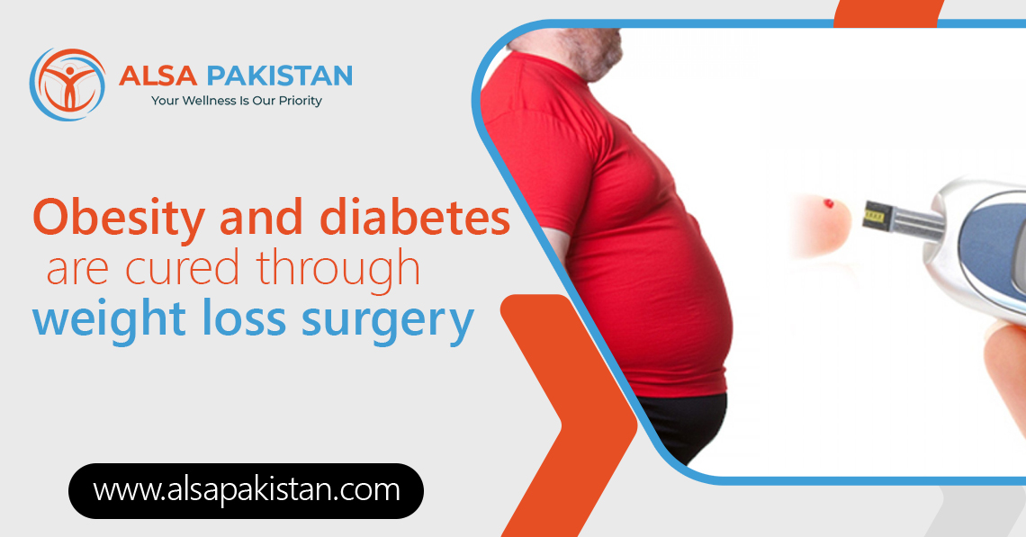 Obesity and diabetes are cured through weight loss surgery