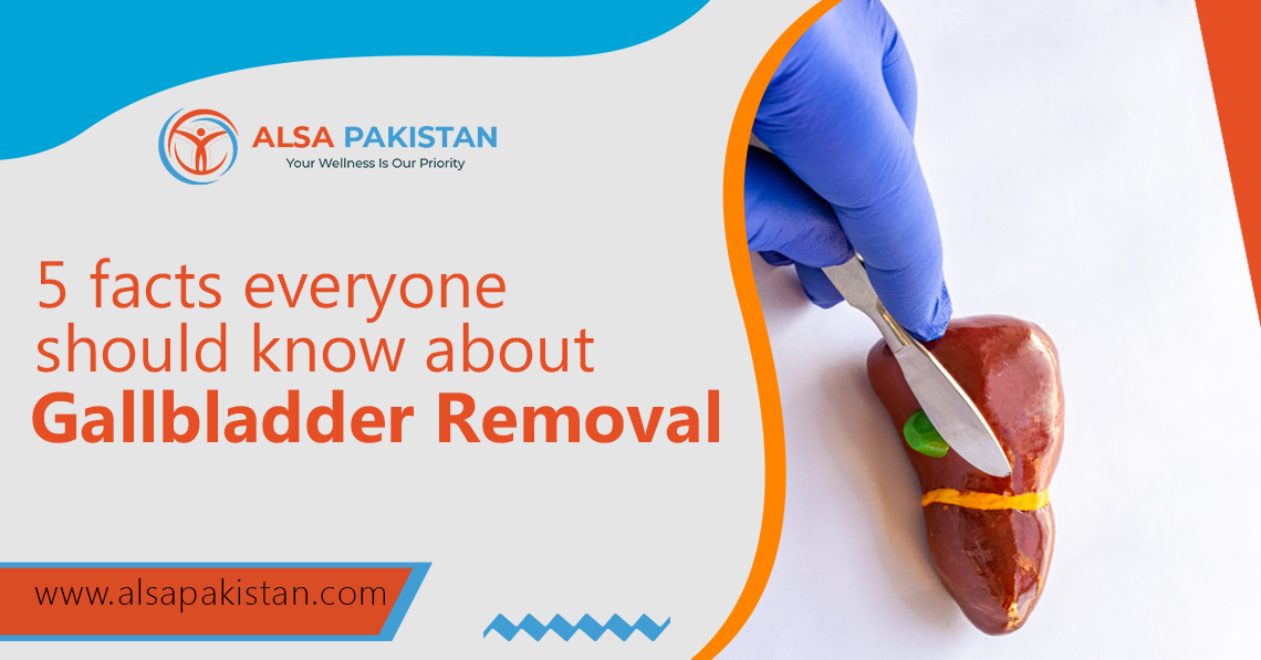 gallbladder removal fact