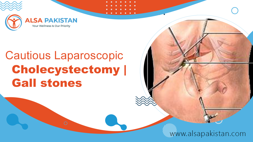 Cautious Laparoscopic Cholecystectomy