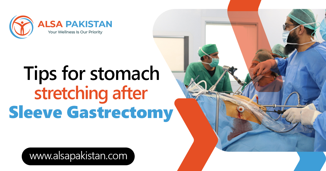 stretching after sleeve gastrectomy