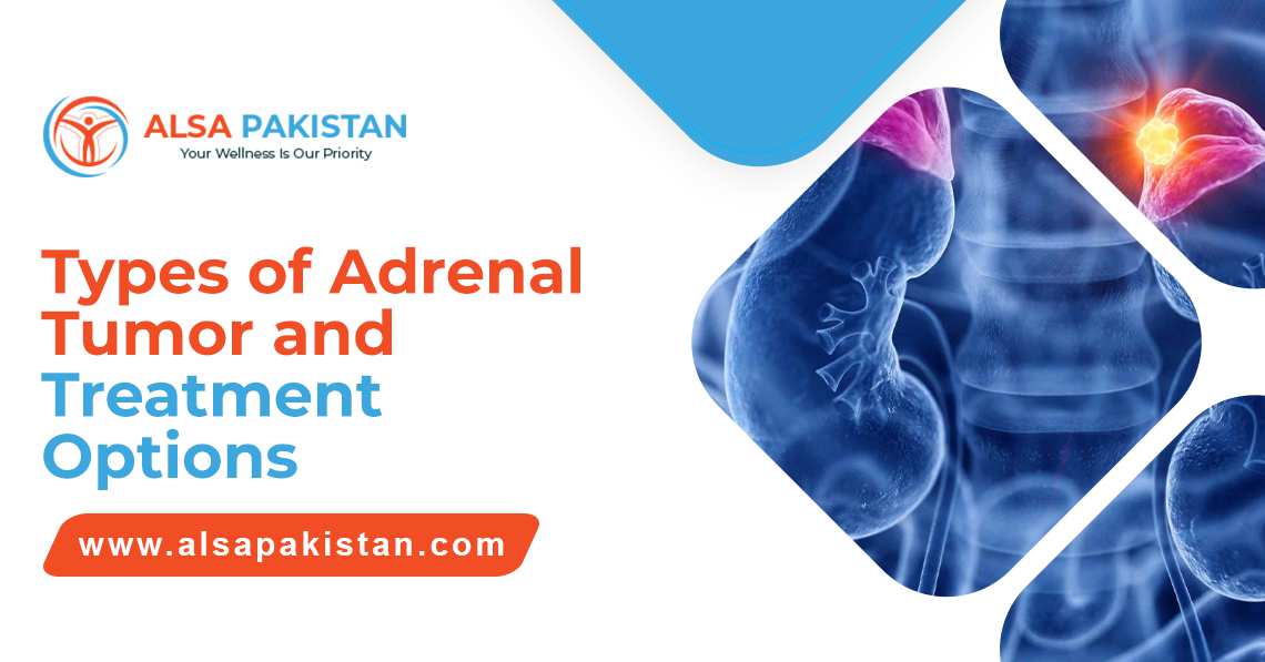 Adrenal tumor and treatment
