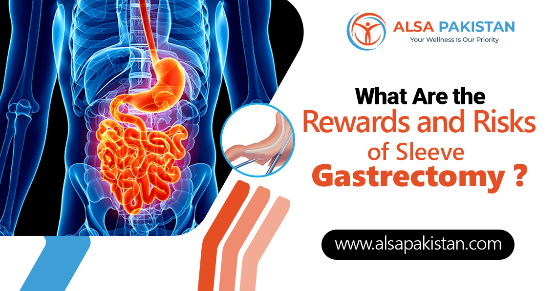 What Are the Rewards and Risks of Sleeve Gastrectomy
