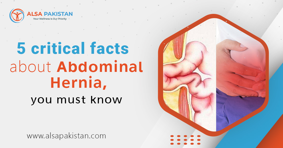 facts about abdominal hernia