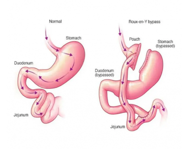 Best Stomach Doctor in Lahore