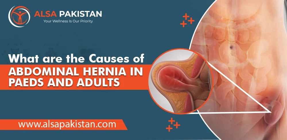 hernia in paeds and adults
