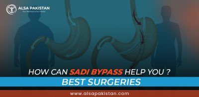 How Can Sadi Bypass Help You? 