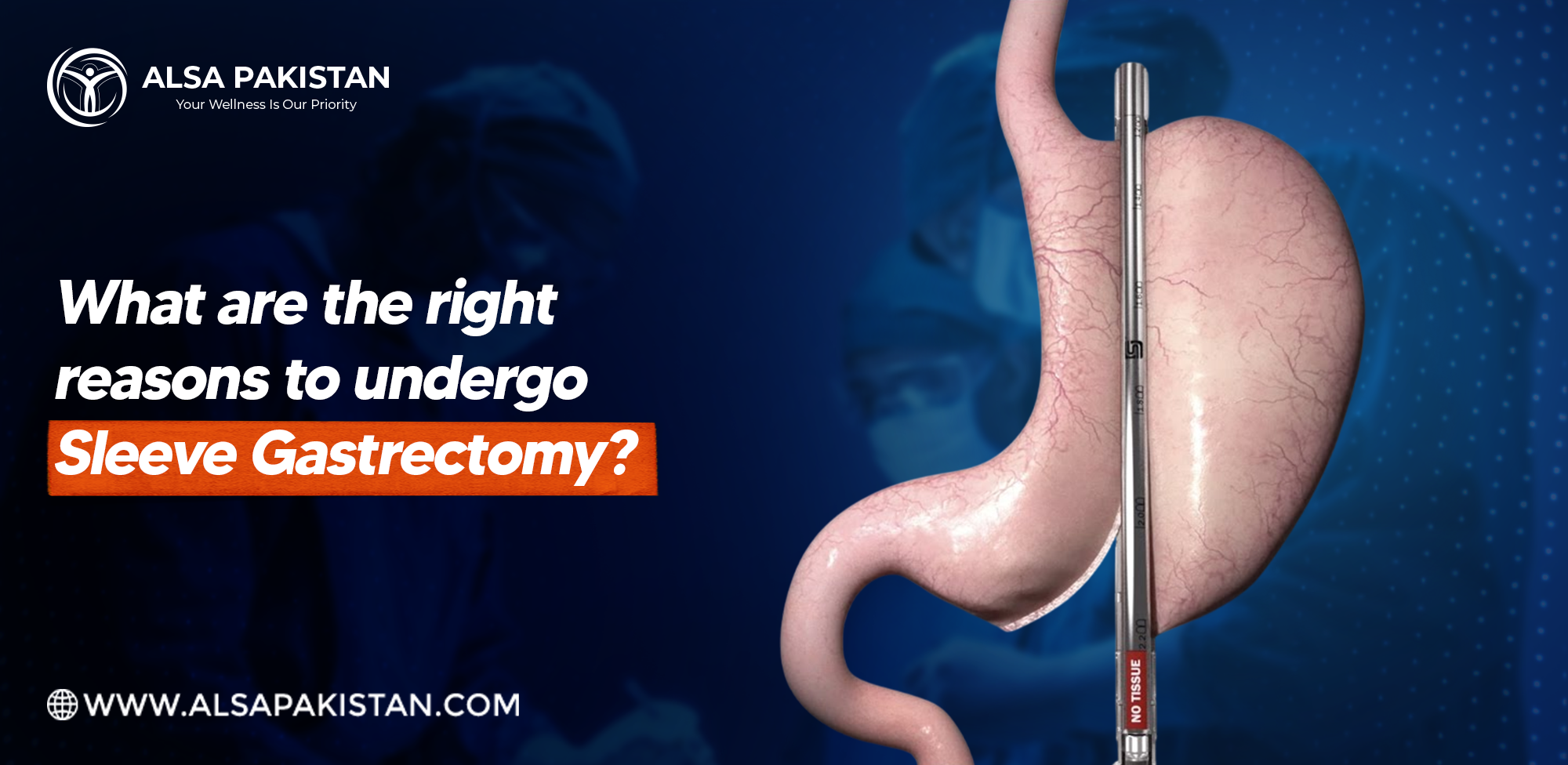 sleeve gastrectomy